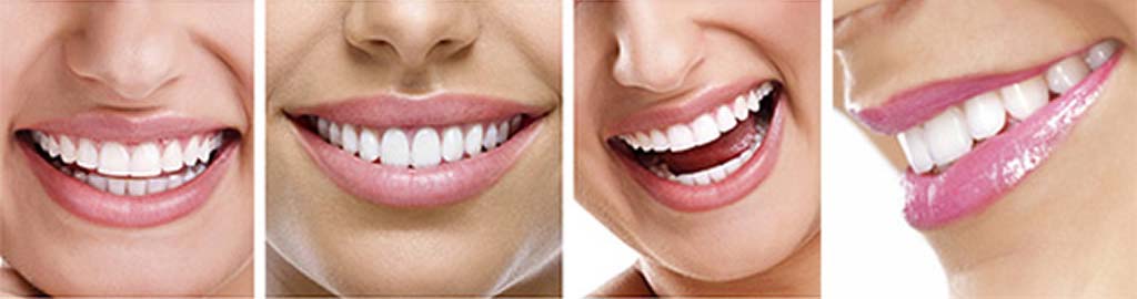 Piano Denta Clinic Gülüş Tasarımı